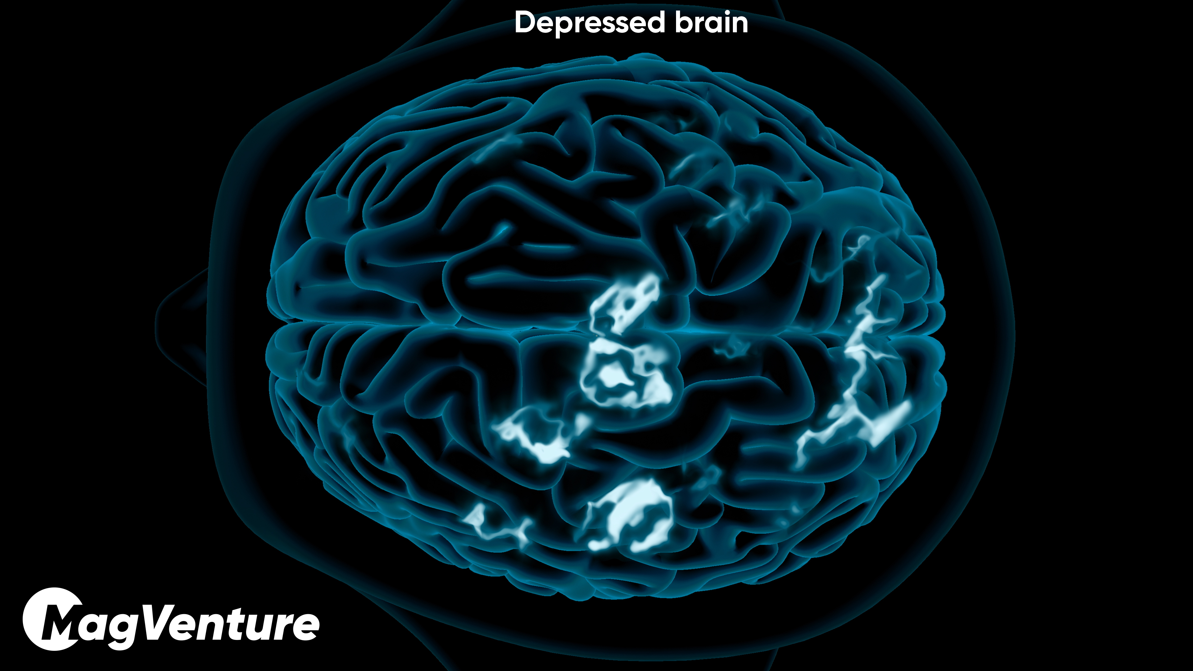 Depressed brain activity illustration
